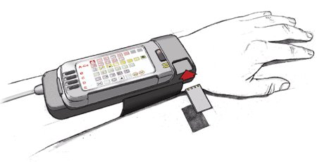 Телефон Icephone для ношения на запястье с поддержкой двух SIM-карт